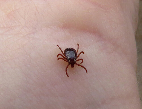 tick bite